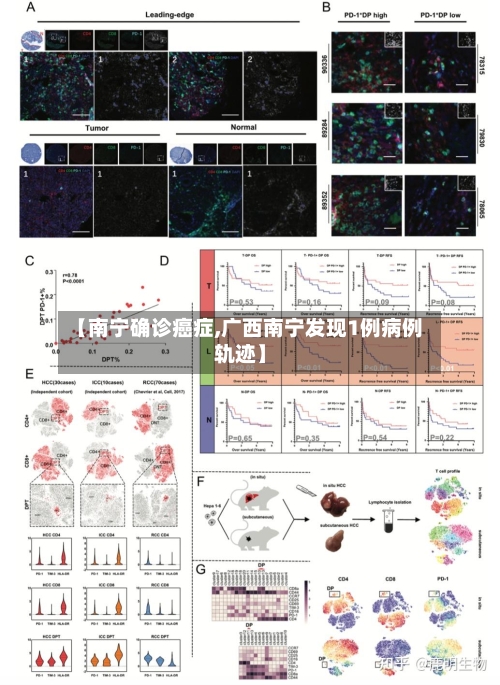 【南宁确诊癌症,广西南宁发现1例病例轨迹】