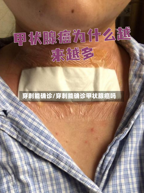 穿刺能确诊/穿刺能确诊甲状腺癌吗