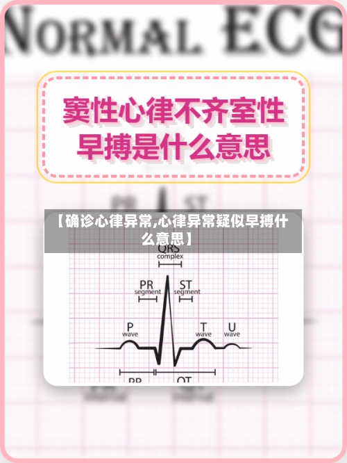 【确诊心律异常,心律异常疑似早搏什么意思】-第3张图片