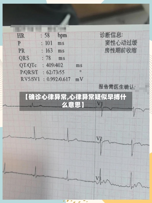 【确诊心律异常,心律异常疑似早搏什么意思】-第2张图片