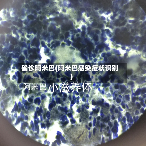 确诊阿米巴(阿米巴感染症状识别)