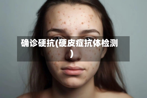 确诊硬抗(硬皮症抗体检测)
