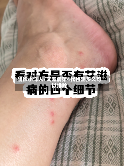 确诊小洋人/艾滋病第4代检测多久可以排除