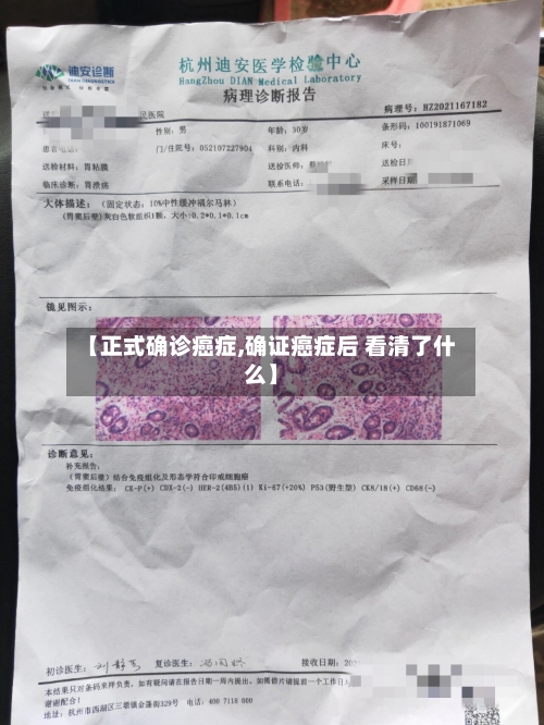 【正式确诊癌症,确证癌症后 看清了什么】