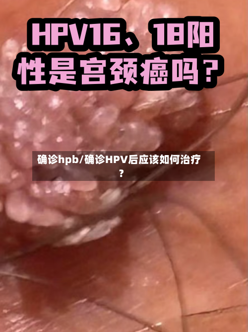 确诊hpb/确诊HPV后应该如何治疗?-第1张图片