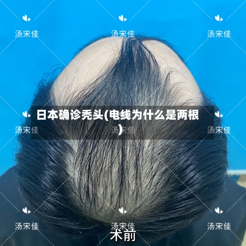 日本确诊秃头(电线为什么是两根)