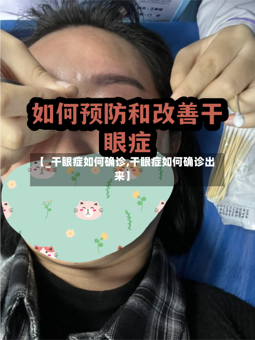 【_干眼症如何确诊,干眼症如何确诊出来】-第2张图片