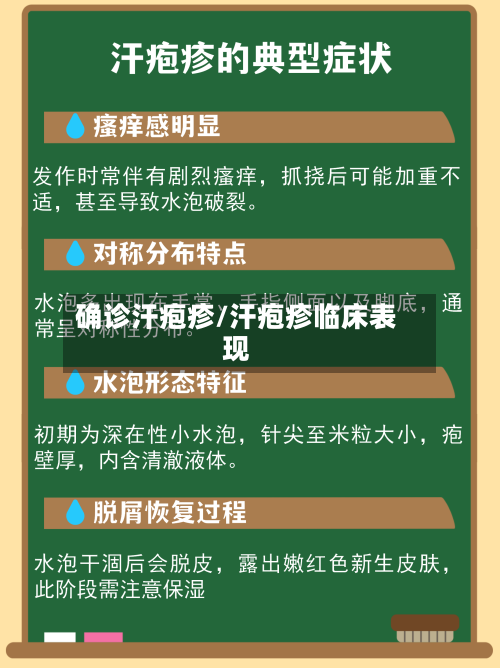 确诊汗疱疹/汗疱疹临床表现-第3张图片