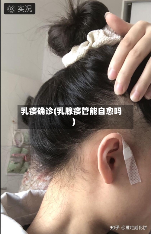 乳瘘确诊(乳腺瘘管能自愈吗)-第2张图片