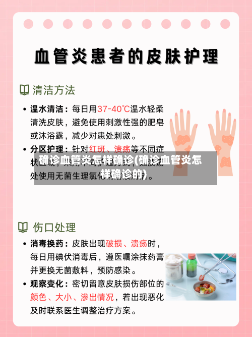 确诊血管炎怎样确诊(确诊血管炎怎样确诊的)-第2张图片