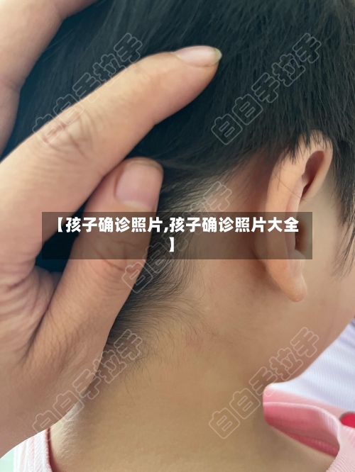 【孩子确诊照片,孩子确诊照片大全】-第2张图片