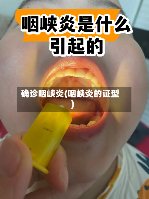 确诊咽峡炎(咽峡炎的证型)-第2张图片
