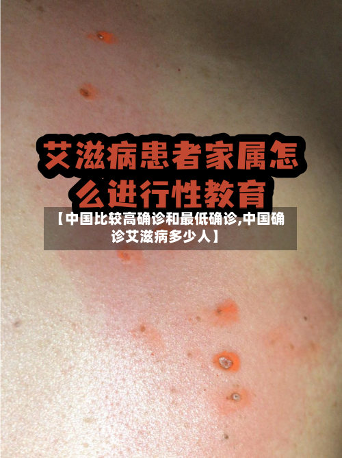 【中国比较高确诊和最低确诊,中国确诊艾滋病多少人】