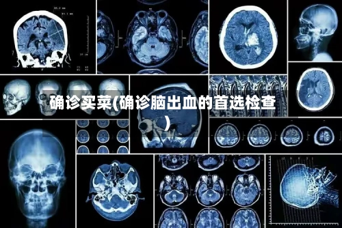 确诊买菜(确诊脑出血的首选检查)-第2张图片