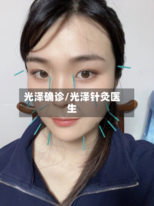 光泽确诊/光泽针灸医生-第2张图片