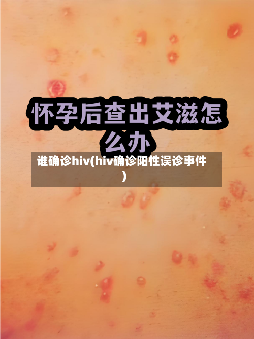 谁确诊hiv(hiv确诊阳性误诊事件)-第2张图片
