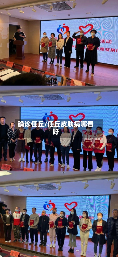 确诊任丘/任丘皮肤病哪看好-第2张图片