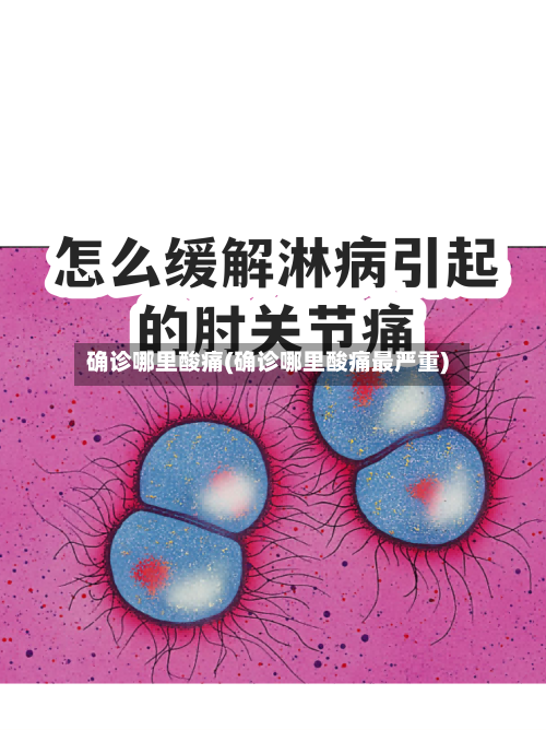 确诊哪里酸痛(确诊哪里酸痛最严重)-第2张图片