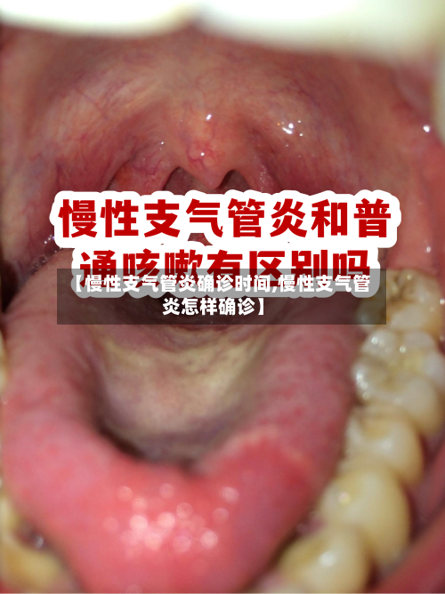 【慢性支气管炎确诊时间,慢性支气管炎怎样确诊】