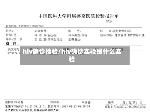 hiv确诊检验/hiv确诊实验是什么实验