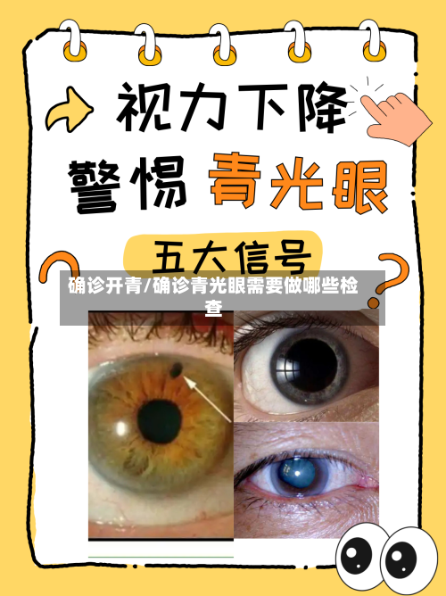 确诊开青/确诊青光眼需要做哪些检查-第2张图片