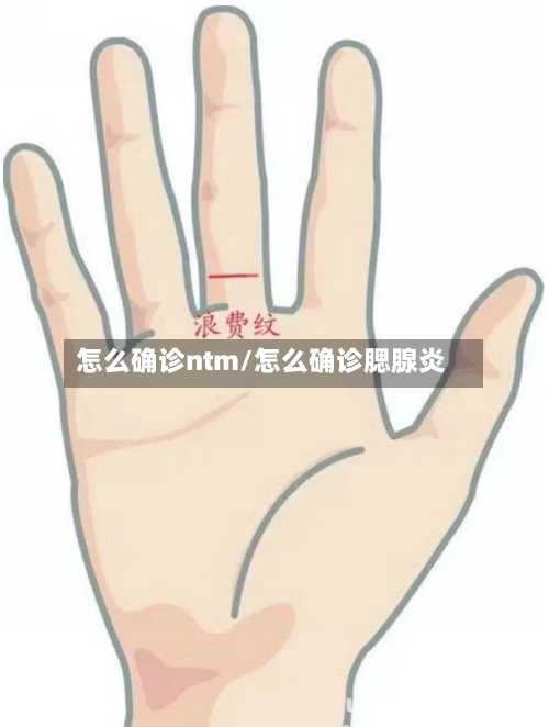 怎么确诊ntm/怎么确诊腮腺炎-第2张图片