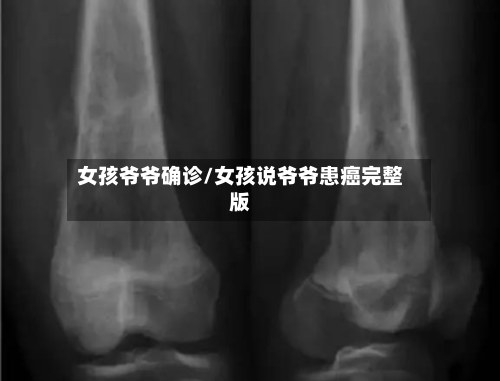 女孩爷爷确诊/女孩说爷爷患癌完整版