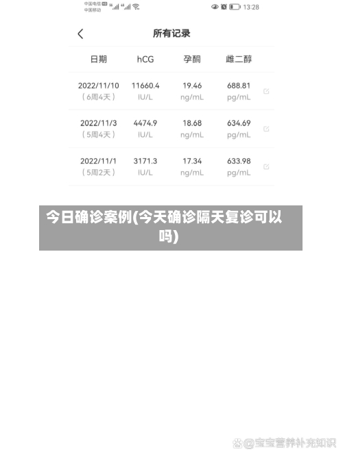今日确诊案例(今天确诊隔天复诊可以吗)