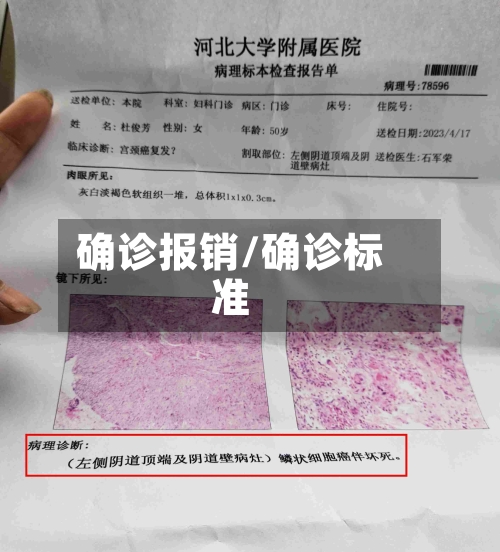 确诊报销/确诊标准-第2张图片