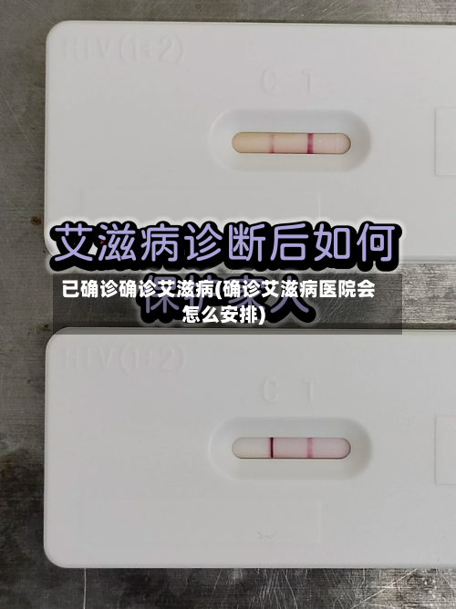 已确诊确诊艾滋病(确诊艾滋病医院会怎么安排)