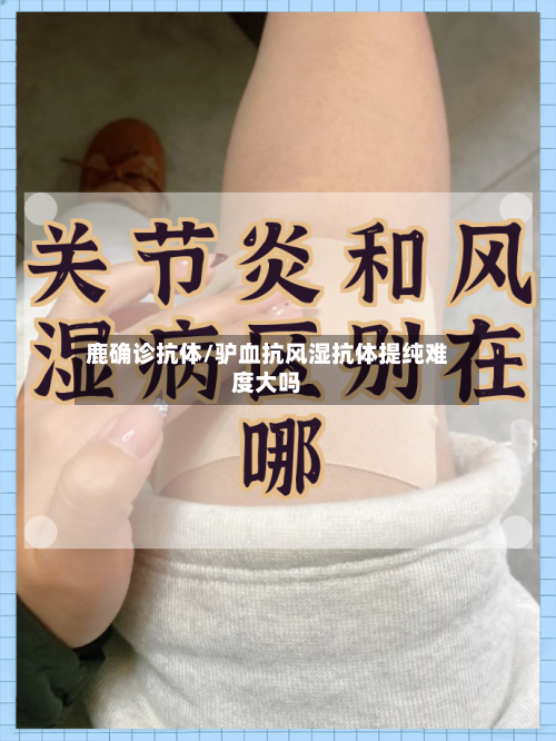 鹿确诊抗体/驴血抗风湿抗体提纯难度大吗-第3张图片