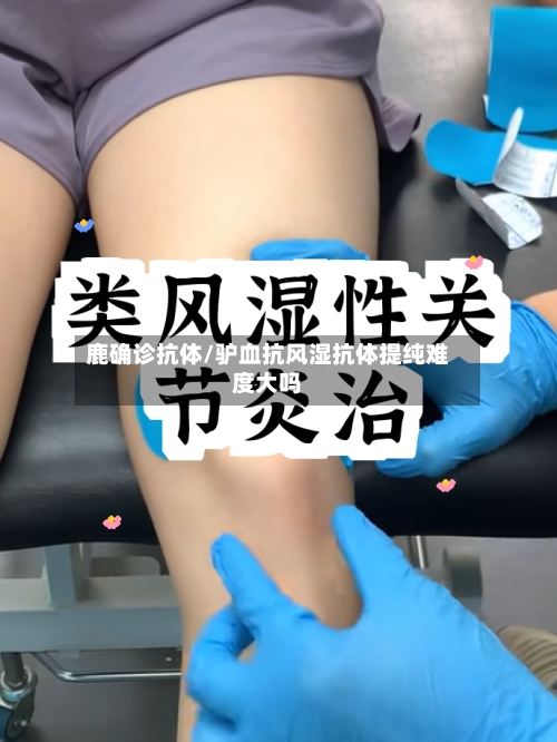 鹿确诊抗体/驴血抗风湿抗体提纯难度大吗-第1张图片