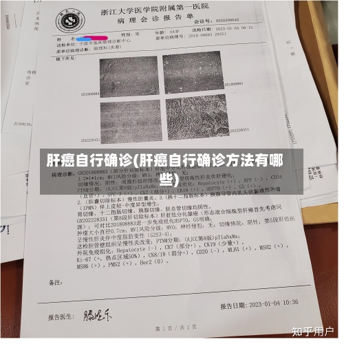 肝癌自行确诊(肝癌自行确诊方法有哪些)