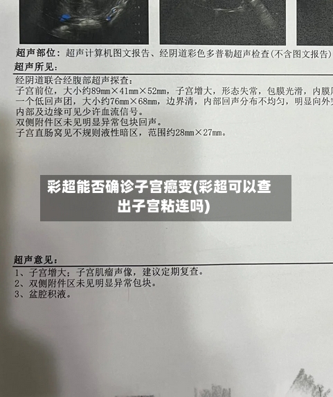 彩超能否确诊子宫癌变(彩超可以查出子宫粘连吗)