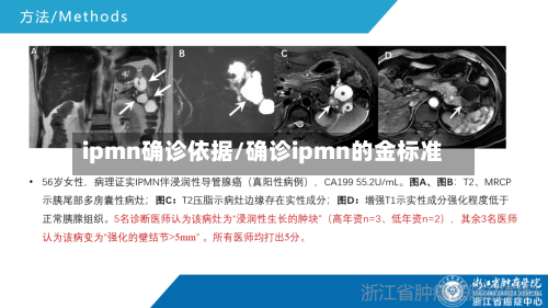 ipmn确诊依据/确诊ipmn的金标准