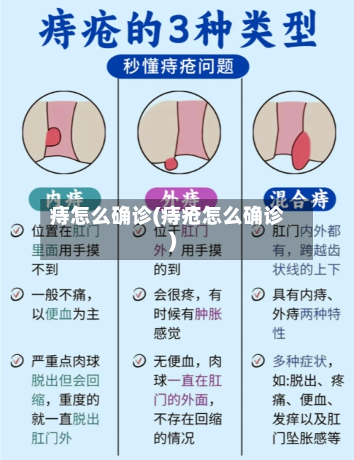 痔怎么确诊(痔疮怎么确诊)