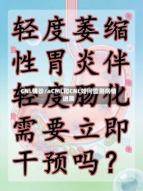 CNL确诊/aCML和CNL如何监测病情进展