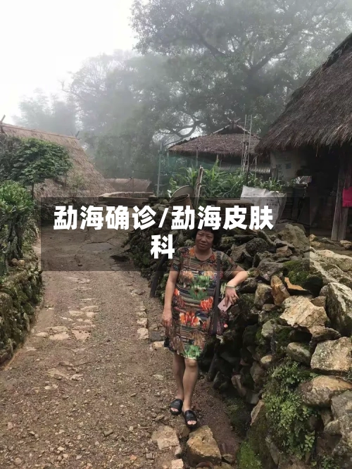 勐海确诊/勐海皮肤科