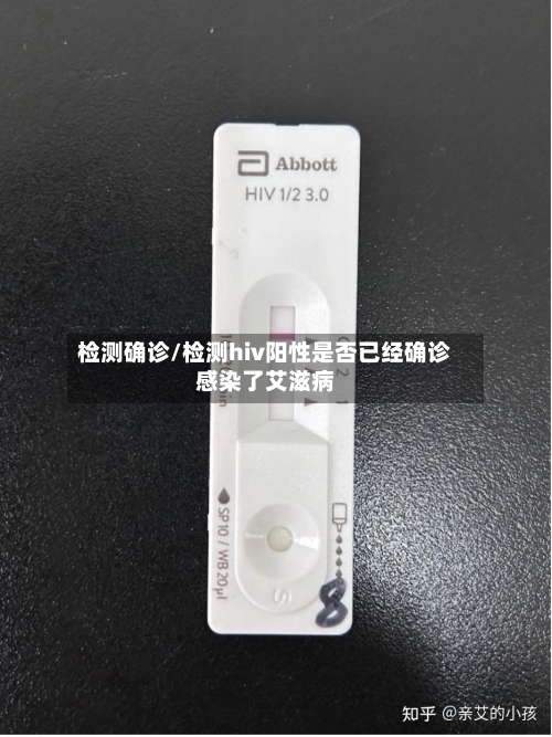 检测确诊/检测hiv阳性是否已经确诊感染了艾滋病