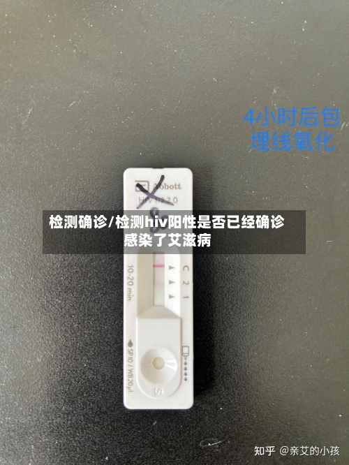 检测确诊/检测hiv阳性是否已经确诊感染了艾滋病-第2张图片
