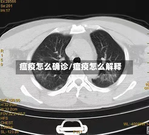 瘟疫怎么确诊/瘟疫怎么解释-第2张图片