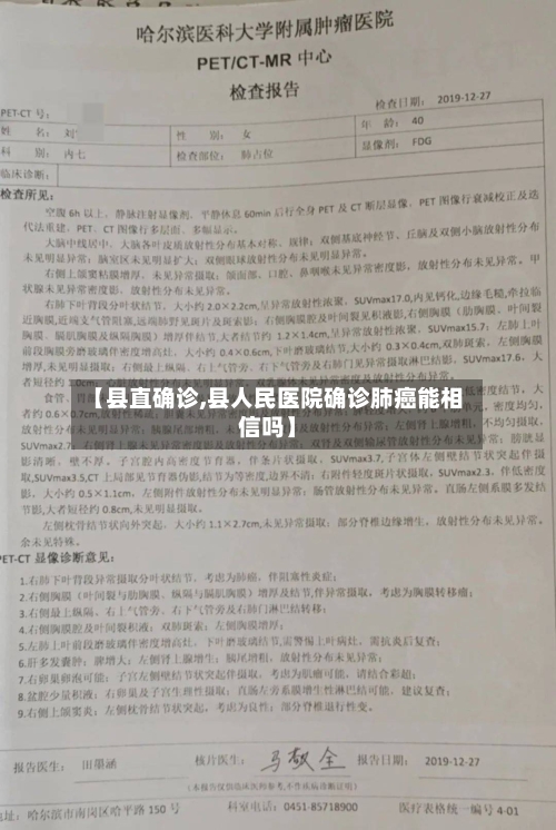 【县直确诊,县人民医院确诊肺癌能相信吗】-第2张图片