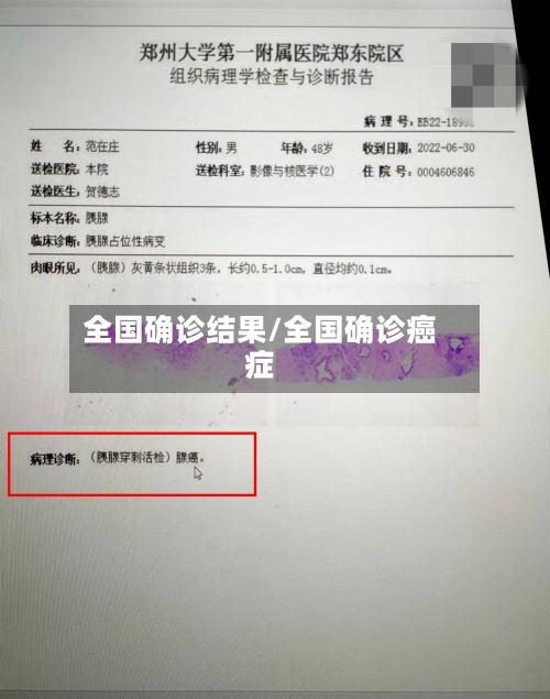 全国确诊结果/全国确诊癌症-第2张图片