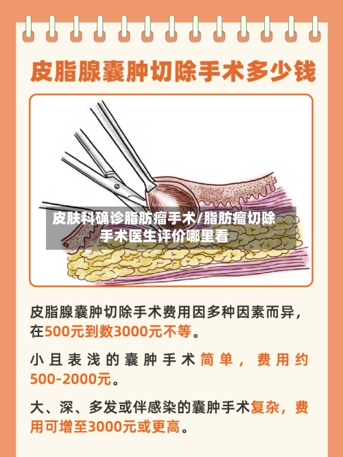 皮肤科确诊脂肪瘤手术/脂肪瘤切除手术医生评价哪里看