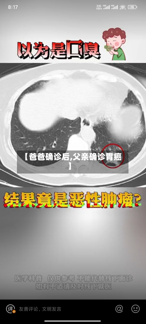 【爸爸确诊后,父亲确诊胃癌】