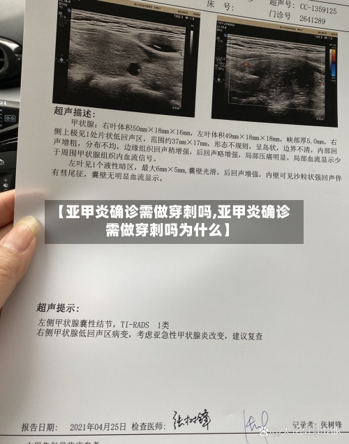 【亚甲炎确诊需做穿刺吗,亚甲炎确诊需做穿刺吗为什么】-第2张图片