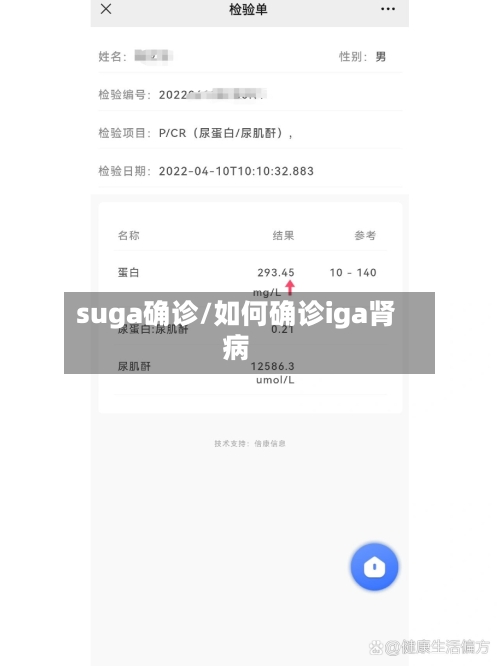 suga确诊/如何确诊iga肾病