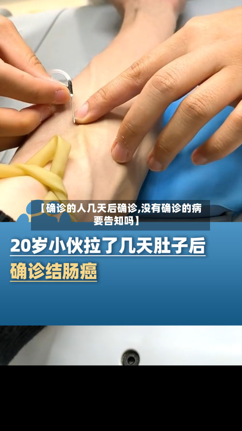 【确诊的人几天后确诊,没有确诊的病要告知吗】