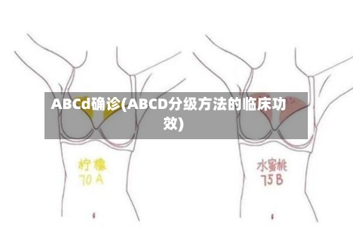 ABCd确诊(ABCD分级方法的临床功效)-第2张图片