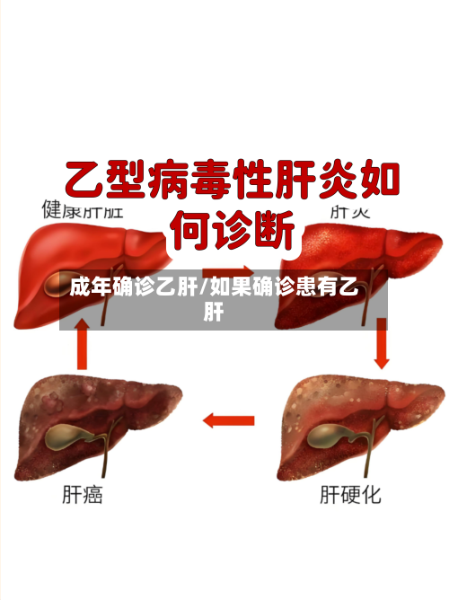 成年确诊乙肝/如果确诊患有乙肝